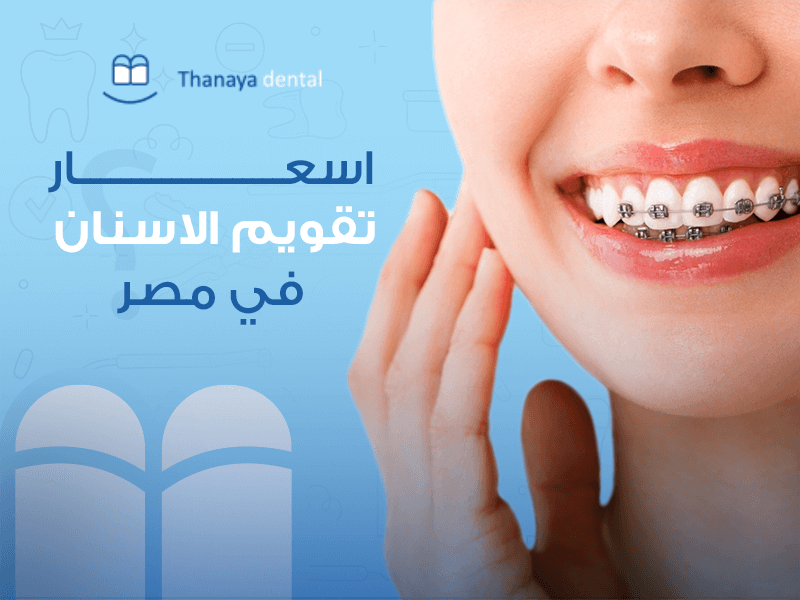 أسعار تقويم الأسنان في مصر