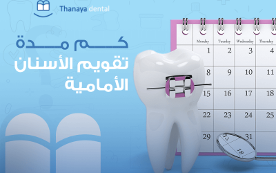 مدة تقويم الأسنان الأمامية,10 حالات تحتاج لتركيبب  الأسنان الأمامية