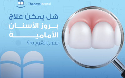 هل يمكن علاج بروز الأسنان الأمامية بدون تقويم؟