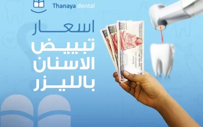 أسعار تبييض الأسنان بالليزر في مصر 2023