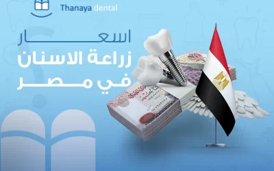 أسعار زراعة الأسنان في مصر- وتحديد الميزانية المناسبة لك