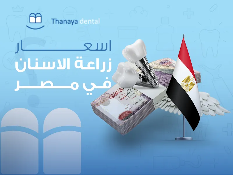 أسعار زراعة الأسنان في مصر
