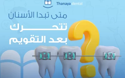 متى تبدا الأسنان تتحرك بعد التقويم ؟
