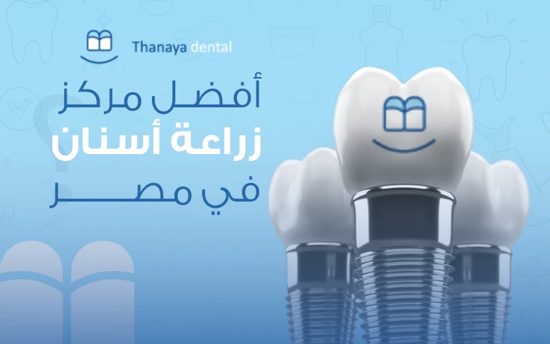أفضل مركز زراعة أسنان في مصر